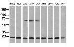 NDUFB10 Antibody in Western Blot (WB)