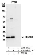 NDUFB6 Antibody in Western Blot (WB)