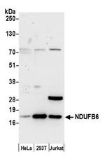 NDUFB6 Antibody in Western Blot (WB)