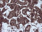 NDUFB9 Antibody in Immunohistochemistry (Paraffin) (IHC (P))