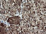 NDUFB9 Antibody in Immunohistochemistry (Paraffin) (IHC (P))