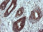 NDUFB9 Antibody in Immunohistochemistry (Paraffin) (IHC (P))