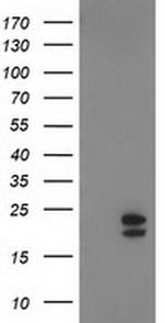 NDUFB9 Antibody in Western Blot (WB)