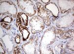 NDUFS2 Antibody in Immunohistochemistry (Paraffin) (IHC (P))