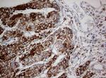 NDUFS2 Antibody in Immunohistochemistry (Paraffin) (IHC (P))