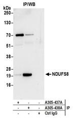 NDUFS8 Antibody in Western Blot (WB)