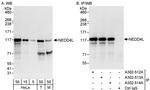 NEDD4L Antibody in Western Blot (WB)