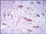 NF-H Antibody in Immunohistochemistry (Paraffin) (IHC (P))