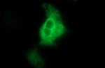 NEFM Antibody in Immunocytochemistry (ICC/IF)