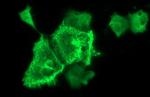 NEFM Antibody in Immunocytochemistry (ICC/IF)