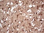 NEFM Antibody in Immunohistochemistry (Paraffin) (IHC (P))