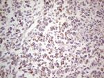 NEFM Antibody in Immunohistochemistry (Paraffin) (IHC (P))