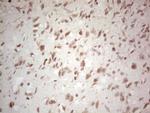 NEFM Antibody in Immunohistochemistry (Paraffin) (IHC (P))