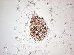 NEFM Antibody in Immunohistochemistry (Paraffin) (IHC (P))