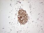 NEFM Antibody in Immunohistochemistry (Paraffin) (IHC (P))