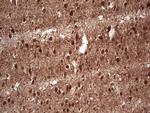 NEFM Antibody in Immunohistochemistry (Paraffin) (IHC (P))