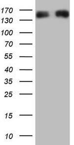 NEFM Antibody in Western Blot (WB)