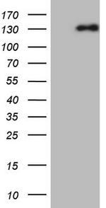 NEFM Antibody in Western Blot (WB)