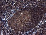 NEK11 Antibody in Immunohistochemistry (Paraffin) (IHC (P))