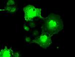 NEK6 Antibody in Immunocytochemistry (ICC/IF)