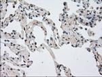 NEK6 Antibody in Immunohistochemistry (Paraffin) (IHC (P))