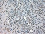 NEK6 Antibody in Immunohistochemistry (Paraffin) (IHC (P))