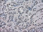 NEK6 Antibody in Immunohistochemistry (Paraffin) (IHC (P))