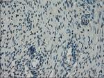 NEK6 Antibody in Immunohistochemistry (Paraffin) (IHC (P))