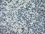 NEK6 Antibody in Immunohistochemistry (Paraffin) (IHC (P))