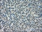 NEK6 Antibody in Immunohistochemistry (Paraffin) (IHC (P))