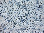 NEK6 Antibody in Immunohistochemistry (Paraffin) (IHC (P))