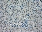 NEK6 Antibody in Immunohistochemistry (Paraffin) (IHC (P))