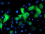 NEK9 Antibody in Immunocytochemistry (ICC/IF)