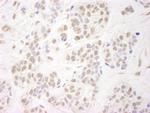 NELFA Antibody in Immunohistochemistry (IHC)