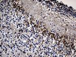 NES Antibody in Immunohistochemistry (Paraffin) (IHC (P))