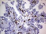 NES Antibody in Immunohistochemistry (Paraffin) (IHC (P))