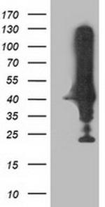 NEU2 Antibody in Western Blot (WB)