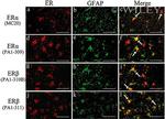 Estrogen Receptor alpha Antibody in Immunohistochemistry (IHC)