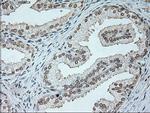 NEUROG1 Antibody in Immunohistochemistry (Paraffin) (IHC (P))