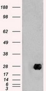 NEUROG1 Antibody in Western Blot (WB)