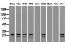 NEUROG1 Antibody in Western Blot (WB)