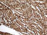 NF Antibody in Immunohistochemistry (Paraffin) (IHC (P))