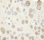 NF-YC Antibody in Immunohistochemistry (IHC)