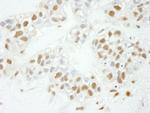 NF-YC Antibody in Immunohistochemistry (IHC)