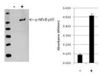 Human NFkB p65 (Phospho) [pS536] InstantOne™ ELISA Kit