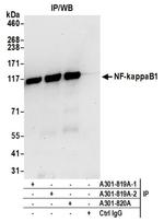 NF-kappaB1 Antibody in Immunoprecipitation (IP)