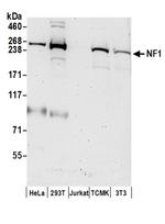 NF1 Antibody in Western Blot (WB)