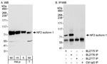 NF2 Antibody in Western Blot (WB)