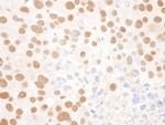 NF45 Antibody in Immunohistochemistry (IHC)