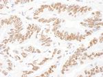 NF45 Antibody in Immunohistochemistry (IHC)